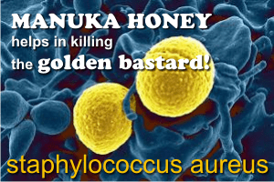 Manuka honey cures staphylococcus aureus infections