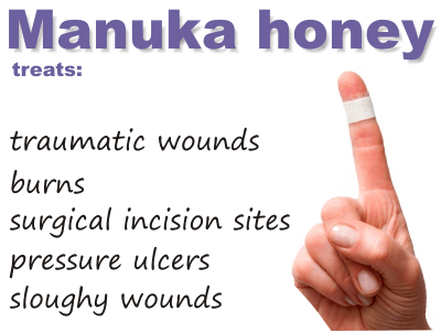 Manuka honey – THE BEST to treat wounds, burns, skin infections.