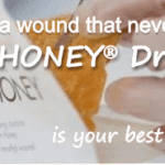 use medihoney for hard to heal wounds and ulcer foot