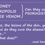 honey propolis and bee venom can cure psoriasis