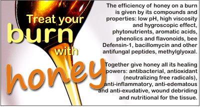 “Does honey help burns?” People are still reluctant but honey is one of the best treatments for a burn!