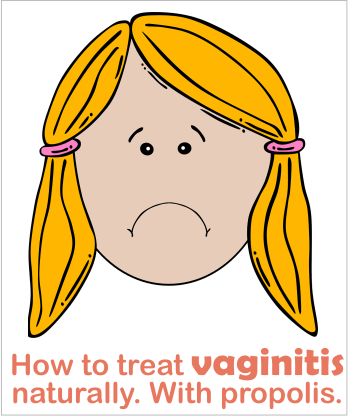 How to treat vaginitis naturally. Have you tried propolis?