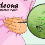 how to get rid of h pylori