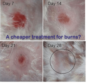What is the best low-cost treatment for burns?